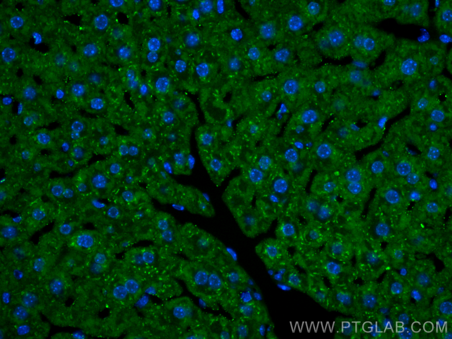 Immunofluorescence (IF) / fluorescent staining of mouse liver tissue using CoraLite® Plus 488-conjugated Alpha 1 Antitrypsin  (CL488-16382)