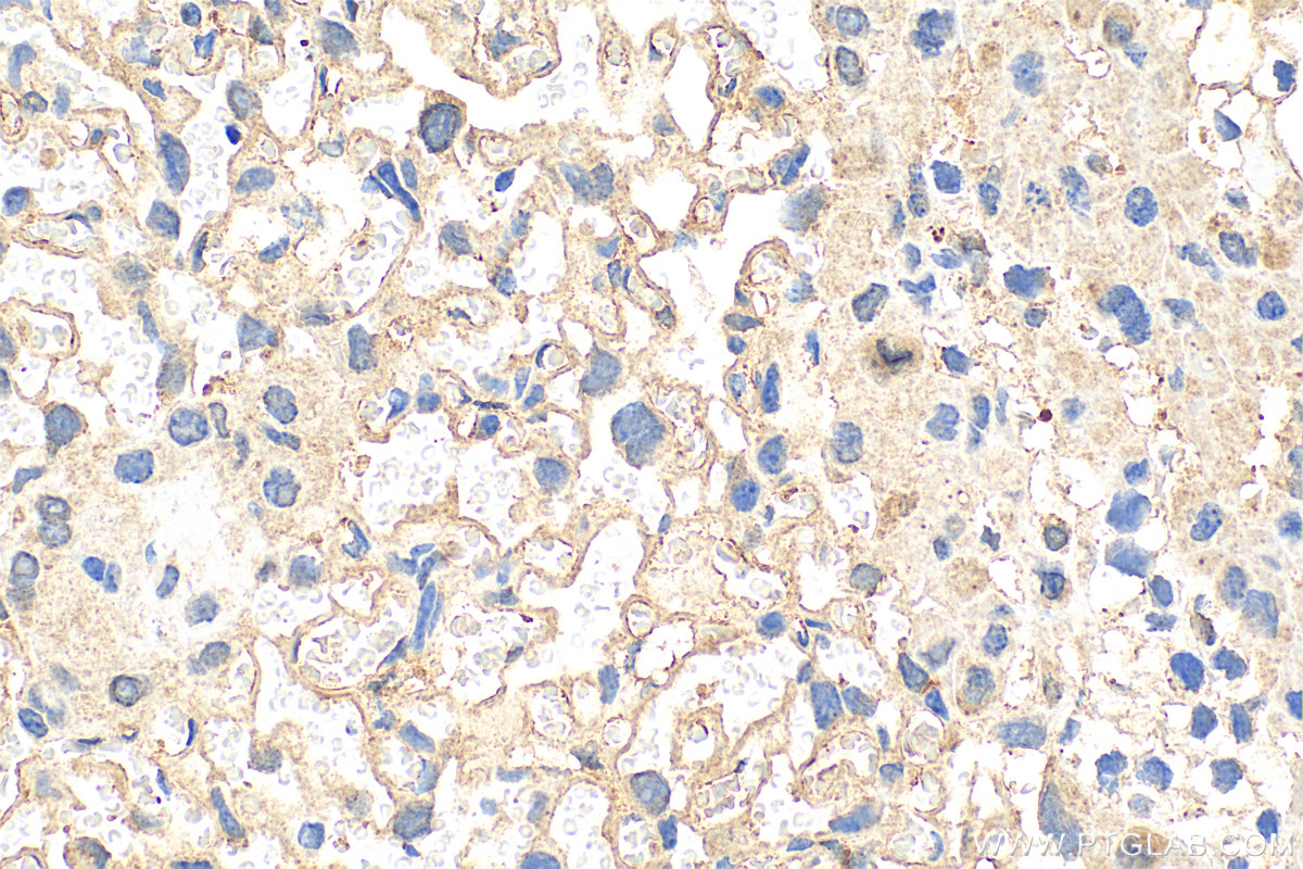 Immunohistochemistry (IHC) staining of mouse placenta tissue using Alpha-1-antitrypsin Polyclonal antibody (25876-1-AP)