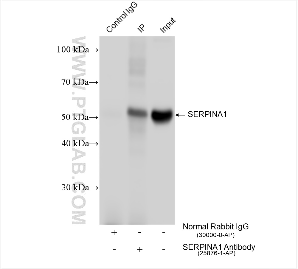 Immunoprecipitation (IP) experiment of human plasma using Alpha-1-antitrypsin Polyclonal antibody (25876-1-AP)