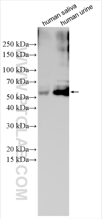 Western Blot (WB) analysis of various lysates using Alpha-1-antitrypsin Polyclonal antibody (25876-1-AP)