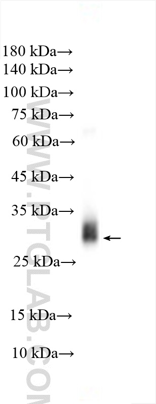 Alpha-1-microglobulin