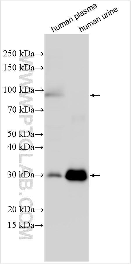 Western Blot (WB) analysis of various lysates using Alpha-1-microglobulin Polyclonal antibody (31801-1-AP)