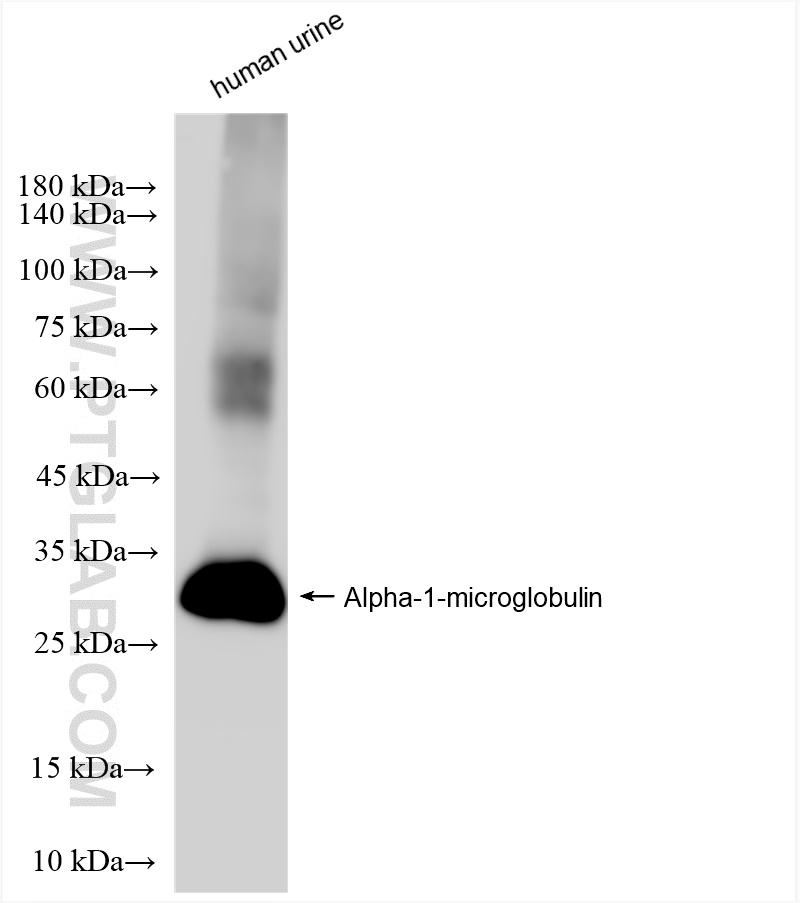 Western Blot (WB) analysis of human urine sample using Alpha-1-microglobulin Recombinant antibody (83678-3-RR)