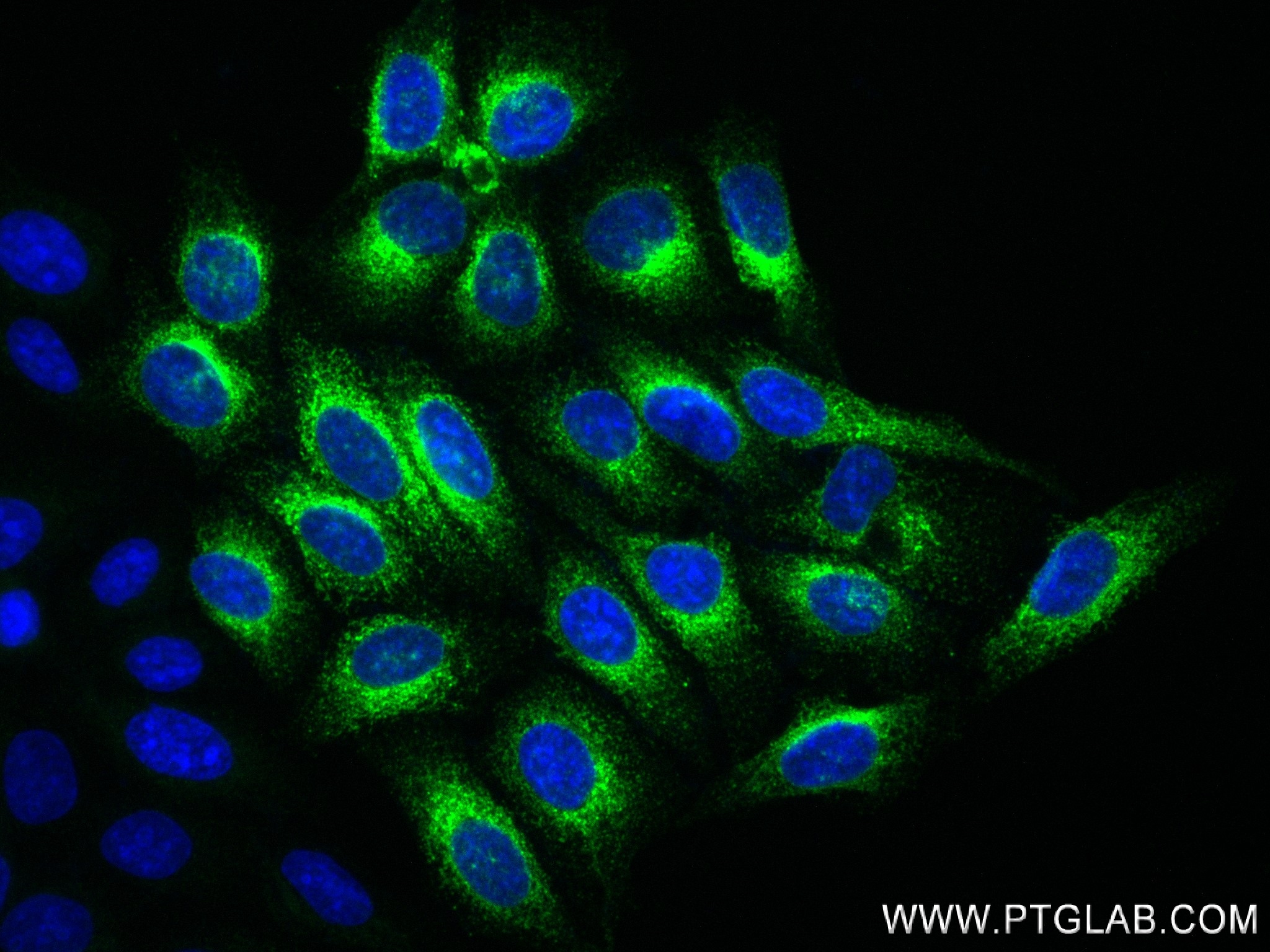 Immunofluorescence (IF) / fluorescent staining of HepG2 cells using Alpha-2-Macroglobulin Recombinant antibody (84347-5-RR)