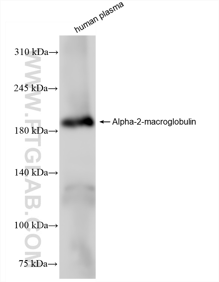 Western Blot (WB) analysis of human plasma using Alpha-2-Macroglobulin Recombinant antibody (84347-5-RR)