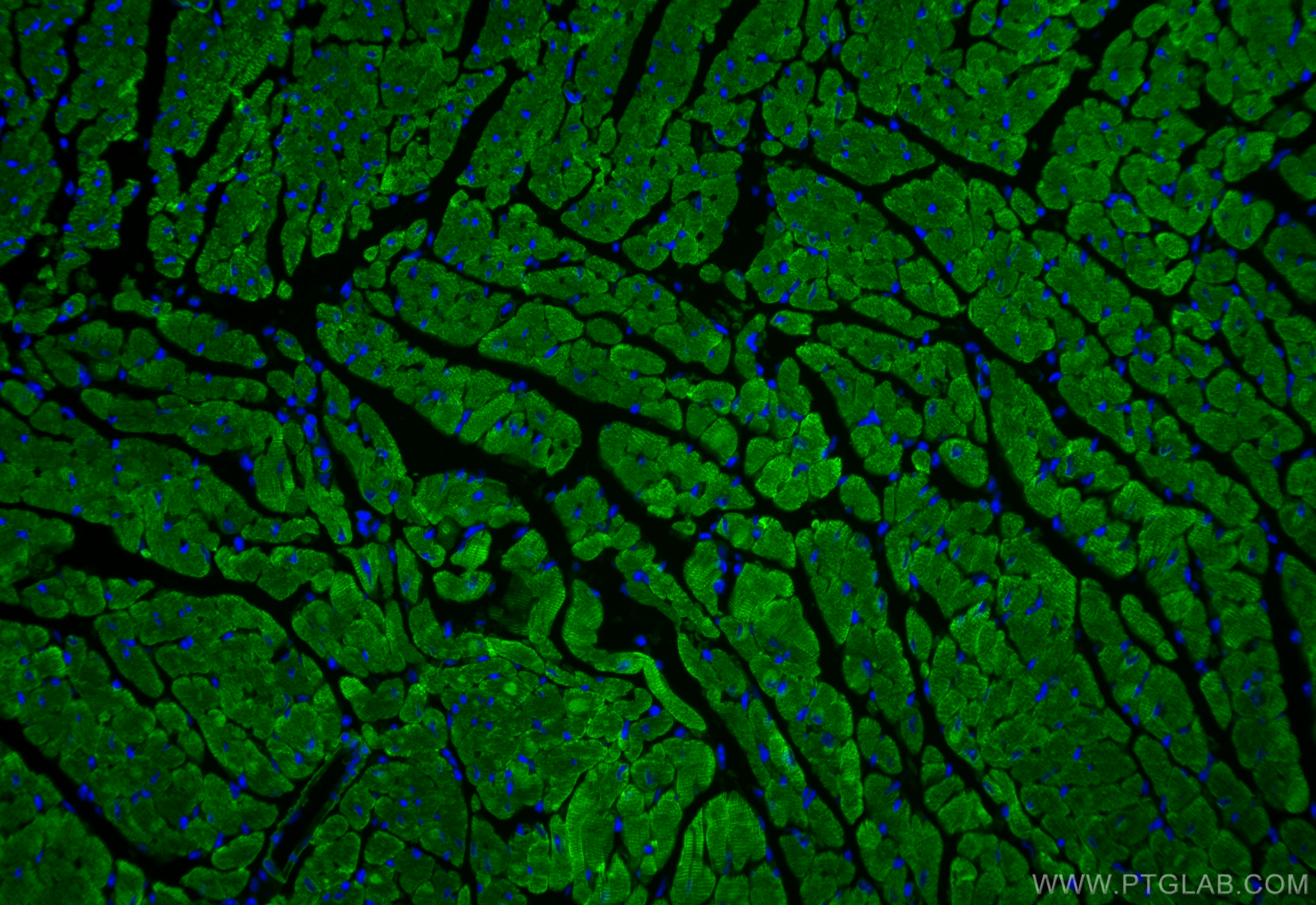 Immunofluorescence (IF) / fluorescent staining of mouse heart tissue using CoraLite® Plus 488-conjugated Alpha Actin Polyclon (CL488-23660)