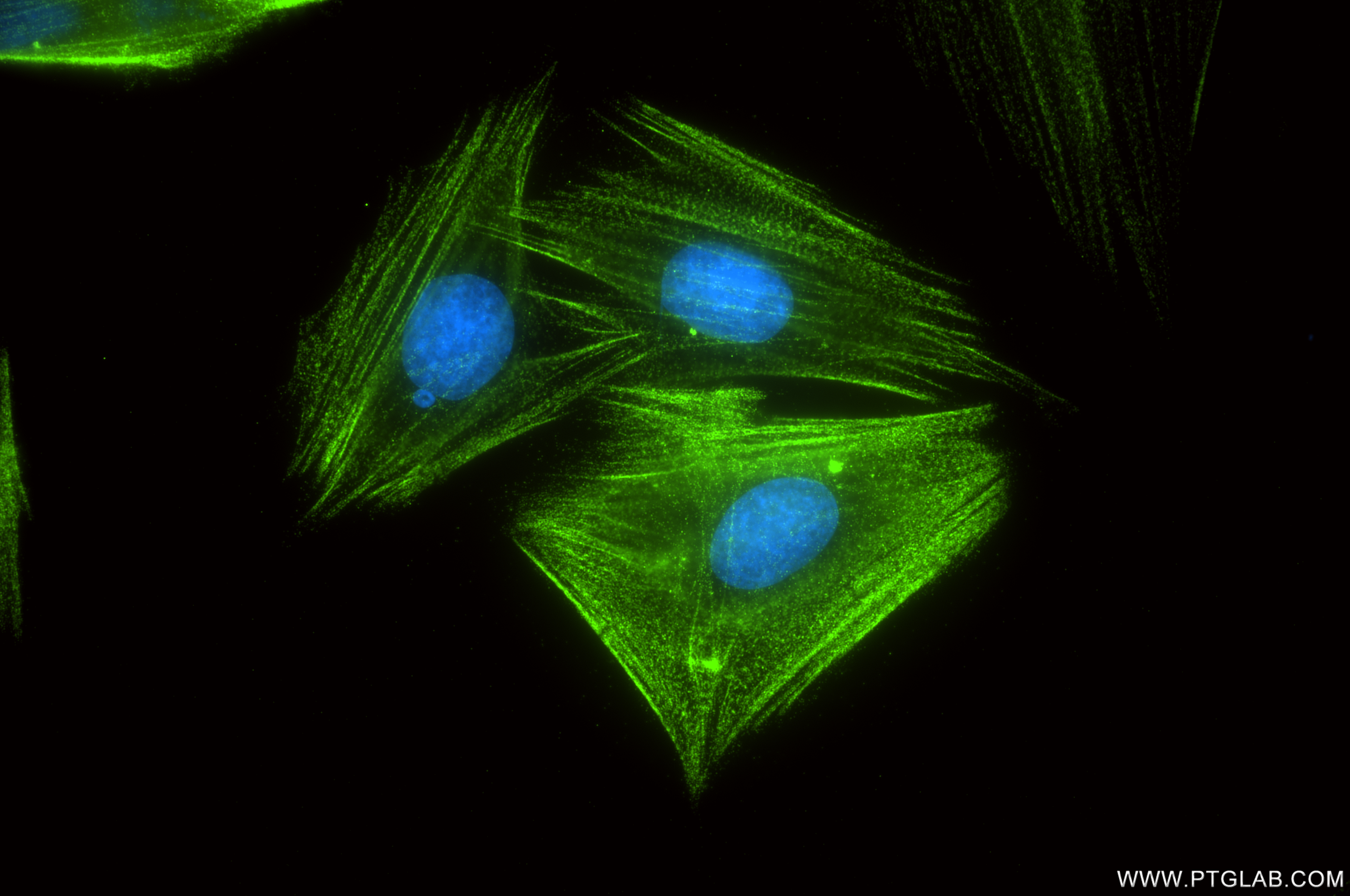 Immunofluorescence (IF) / fluorescent staining of H9C2 cells using Alpha Actinin Recombinant antibody (86340-2-RR)