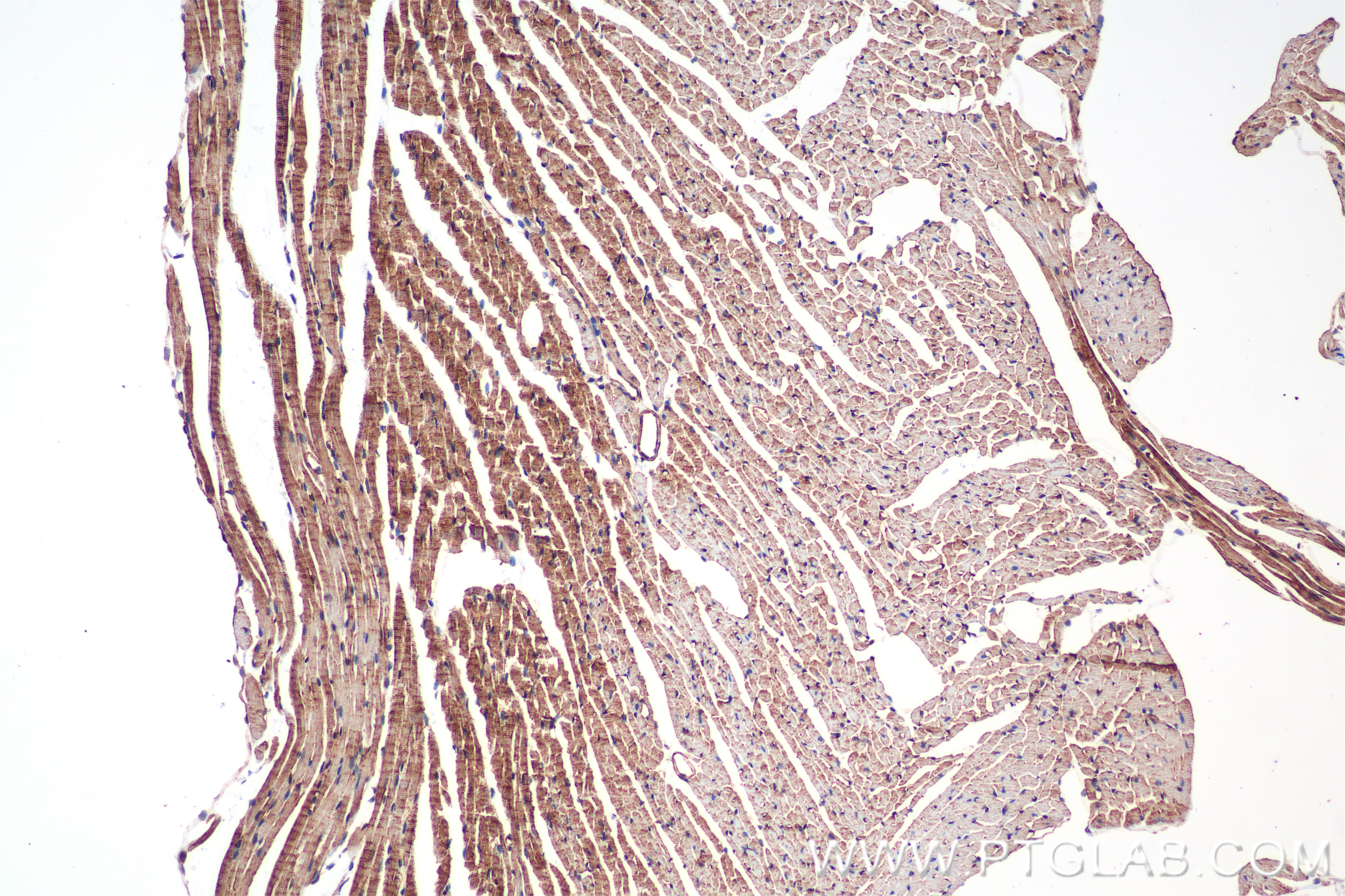 Immunohistochemistry (IHC) staining of mouse heart tissue using Alpha Actinin Recombinant antibody (86340-2-RR)