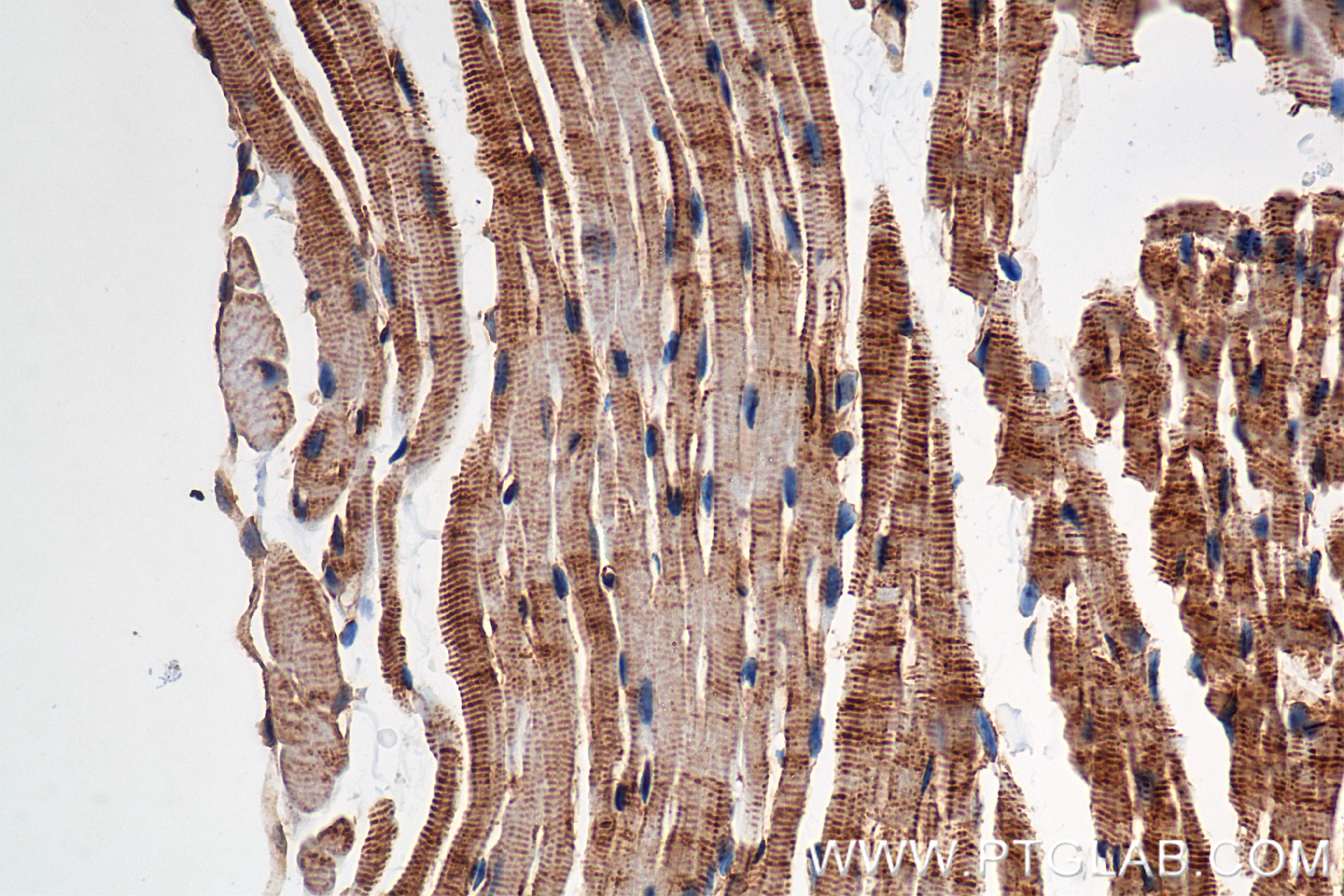 Immunohistochemistry (IHC) staining of mouse heart tissue using Alpha Actinin Recombinant antibody (86340-2-RR)