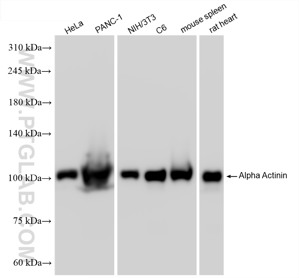 Western Blot (WB) analysis of various lysates using Alpha Actinin Recombinant antibody (86340-2-RR)