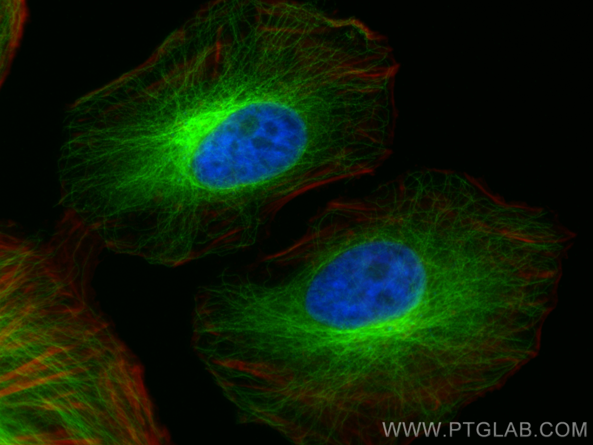 Immunofluorescence (IF) / fluorescent staining of HeLa cells using Alpha Tubulin Recombinant antibody (80762-1-RR)