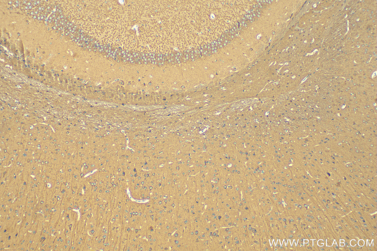 Immunohistochemistry (IHC) staining of mouse brain tissue using Alpha Tubulin Recombinant antibody (80762-1-RR)