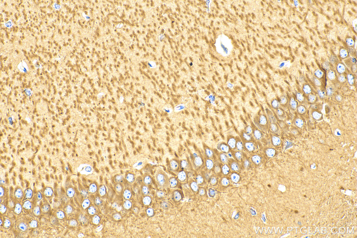 Immunohistochemistry (IHC) staining of mouse brain tissue using Alpha Tubulin Recombinant antibody (80762-1-RR)