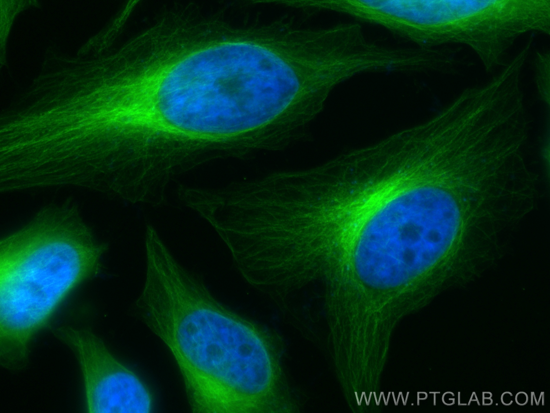 Immunofluorescence (IF) / fluorescent staining of HeLa cells using CoraLite® Plus 488-conjugated Alpha Tubulin Recomb (CL488-80762)