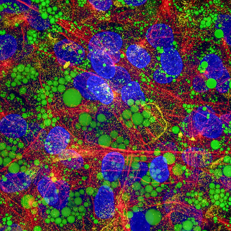 Immunofluorescence (IF) / fluorescent staining of human adipose-derived mesenchymal stem cells using CoraLite®594-conjugated Alpha Tubulin Recombinant  (CL594-80762)