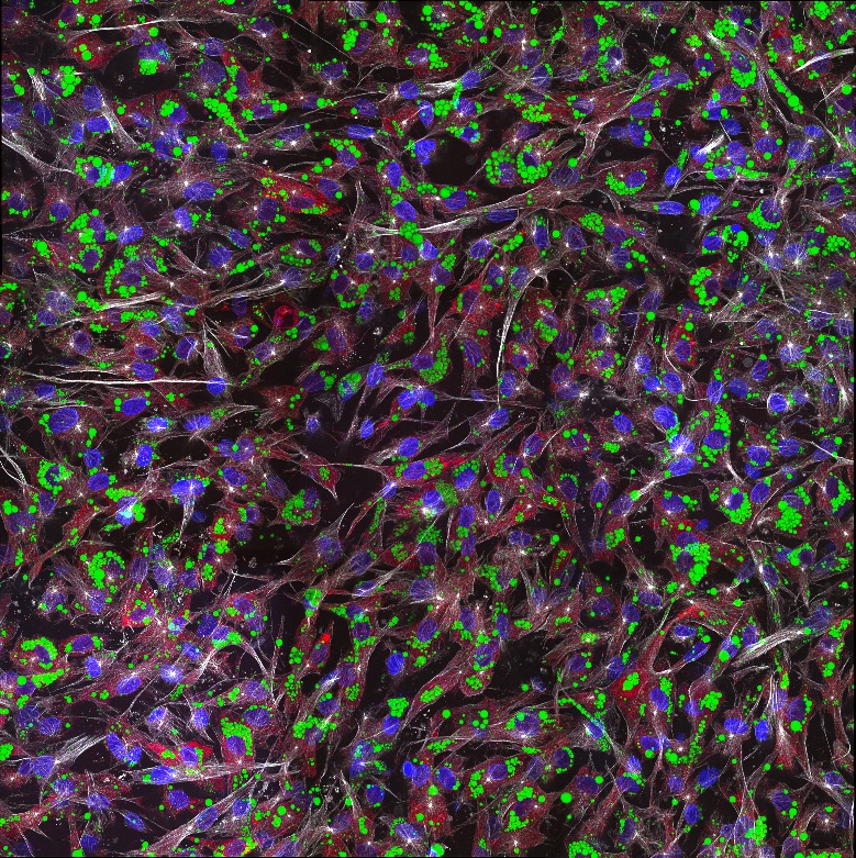 Immunofluorescence (IF) / fluorescent staining of human adipose-derived mesenchymal stem cells using CoraLite®594-conjugated Alpha Tubulin Recombinant  (CL594-80762)