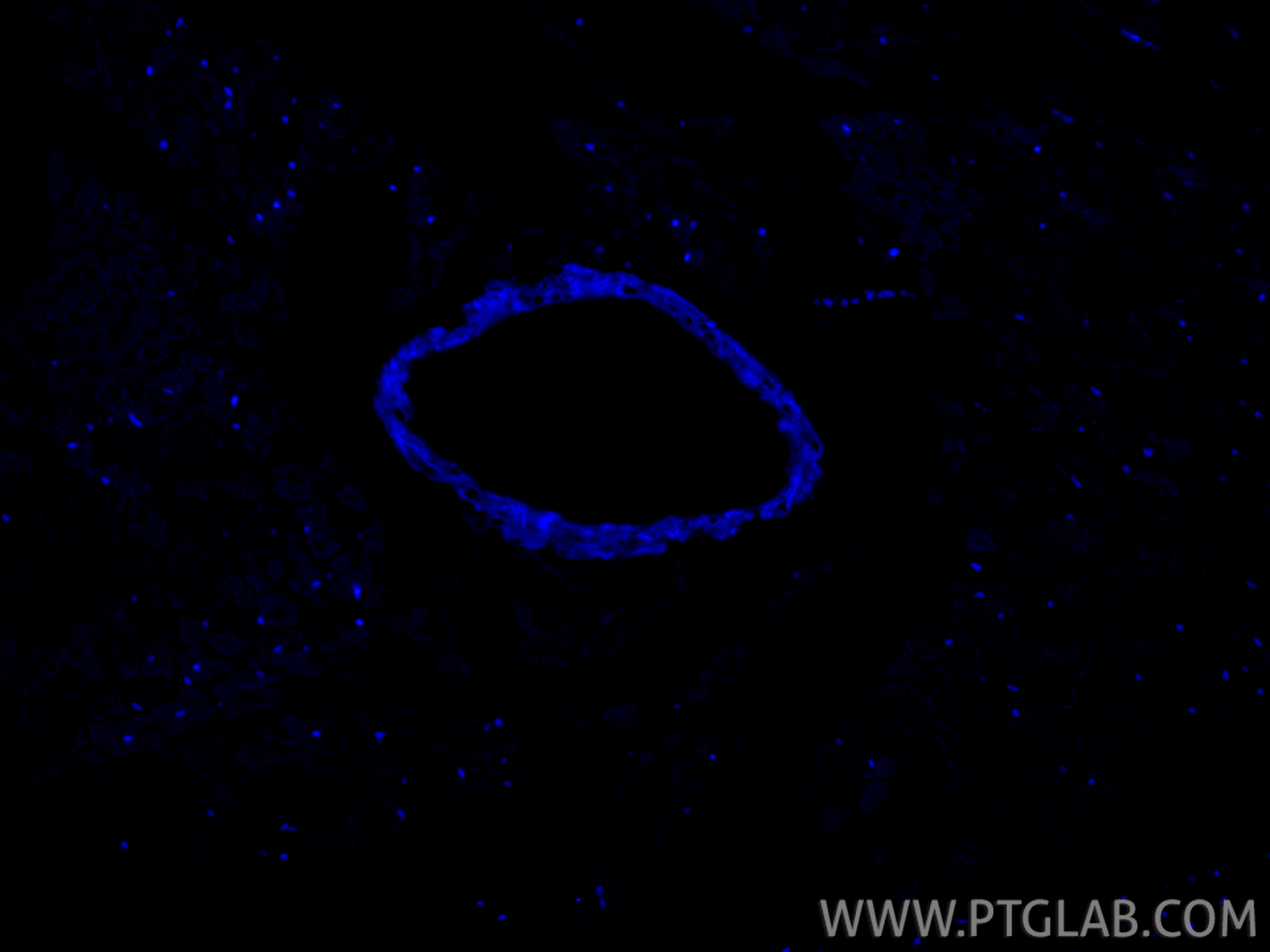 Immunofluorescence (IF) / fluorescent staining of rat heart tissue using CoraLite® Plus 405-conjugated Alpha smooth muscle  (CL405-80008)