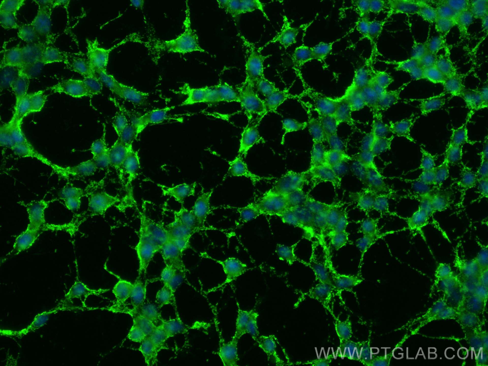 Immunofluorescence (IF) / fluorescent staining of SH-SY5Y cells using APP/Beta Amyloid Polyclonal antibody (25524-1-AP)