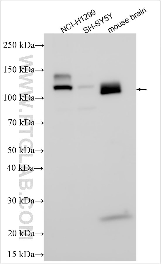 Western Blot (WB) analysis of various lysates using APP/Beta Amyloid Polyclonal antibody (25524-1-AP)