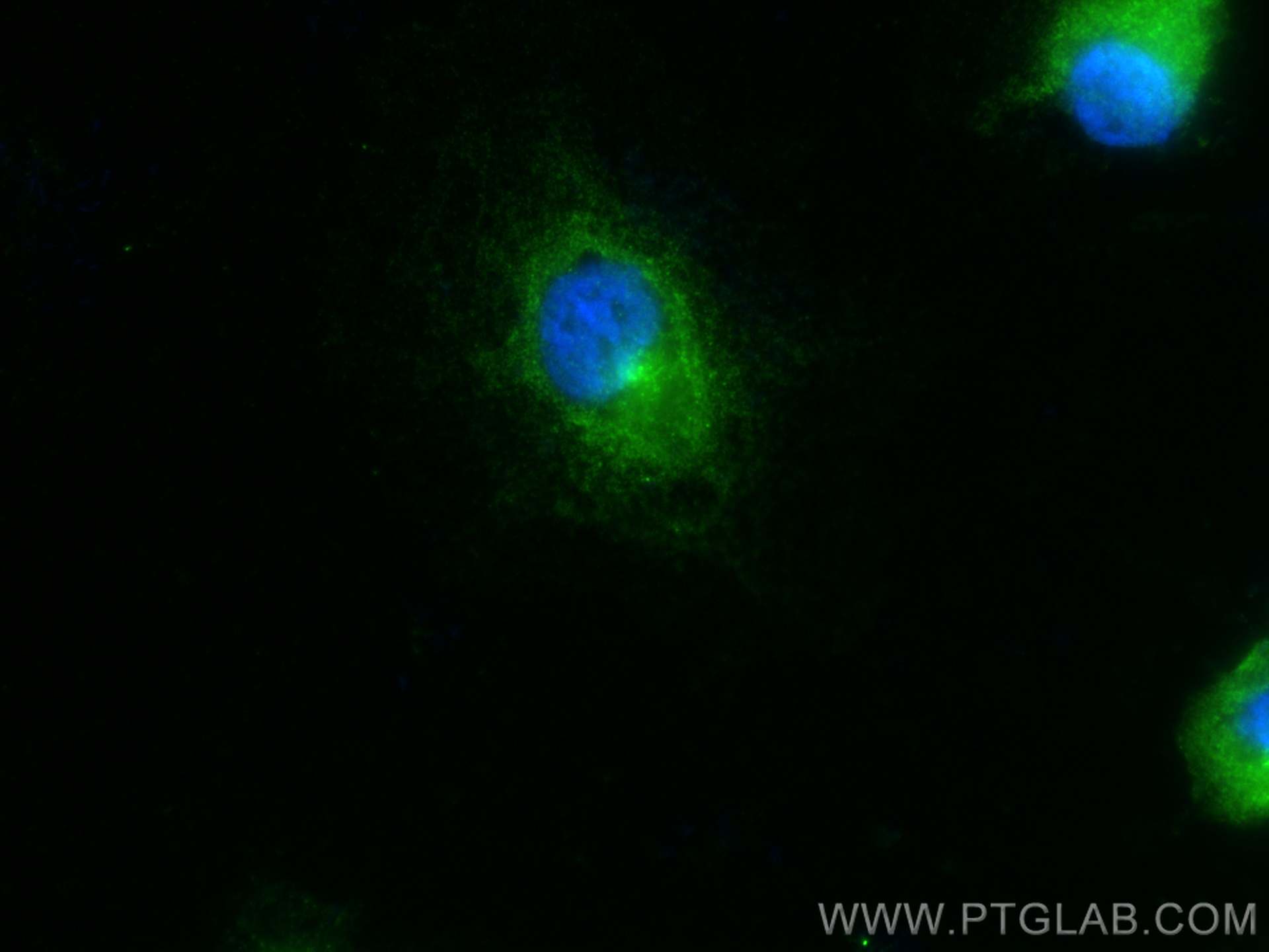 Immunofluorescence (IF) / fluorescent staining of HUVEC cells using Angiopoietin 1 Polyclonal antibody (27093-1-AP)