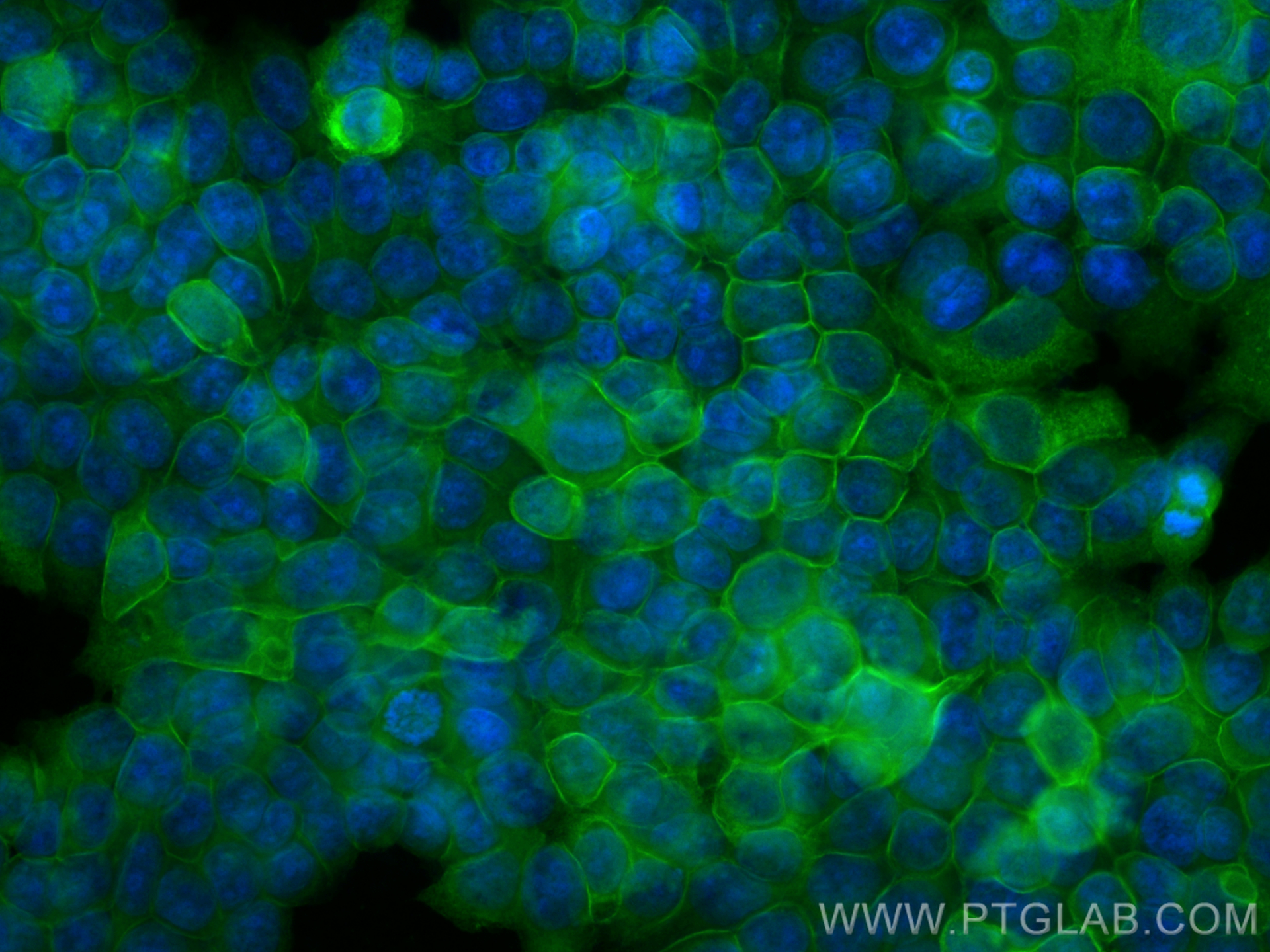 Immunofluorescence (IF) / fluorescent staining of MCF-7 cells using CoraLite® Plus 488-conjugated Annexin A2 Polyclona (CL488-11256)