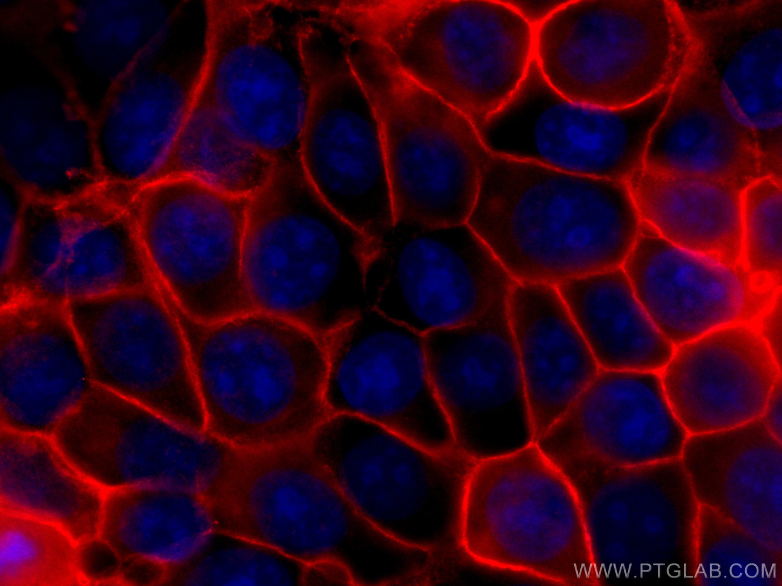 Immunofluorescence (IF) / fluorescent staining of MCF-7 cells using CoraLite®594-conjugated Annexin A2 Polyclonal anti (CL594-11256)