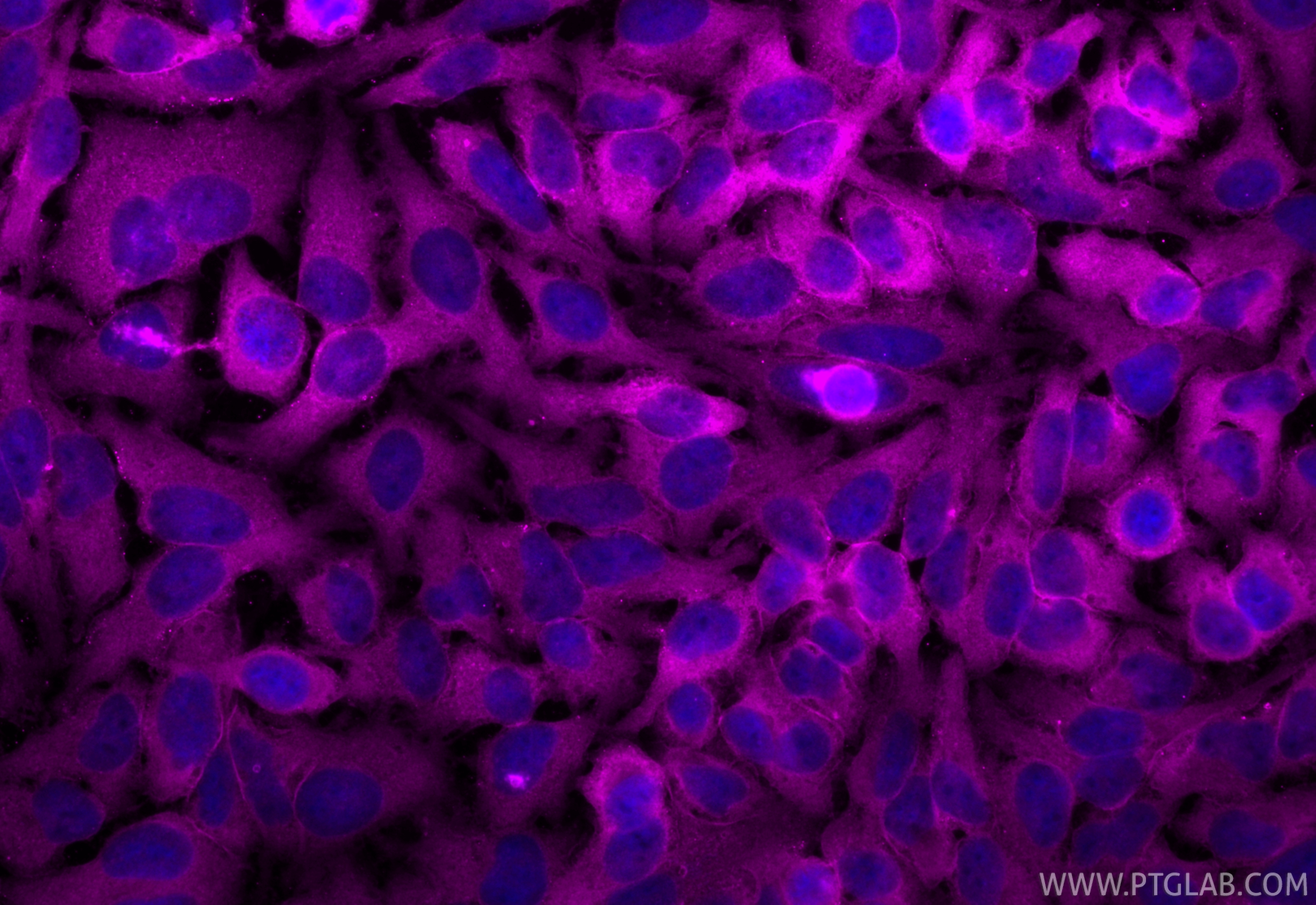 Immunofluorescence (IF) / fluorescent staining of HeLa cells using CoraLite® Plus 647-conjugated Annexin V Polyclonal (CL647-11060)