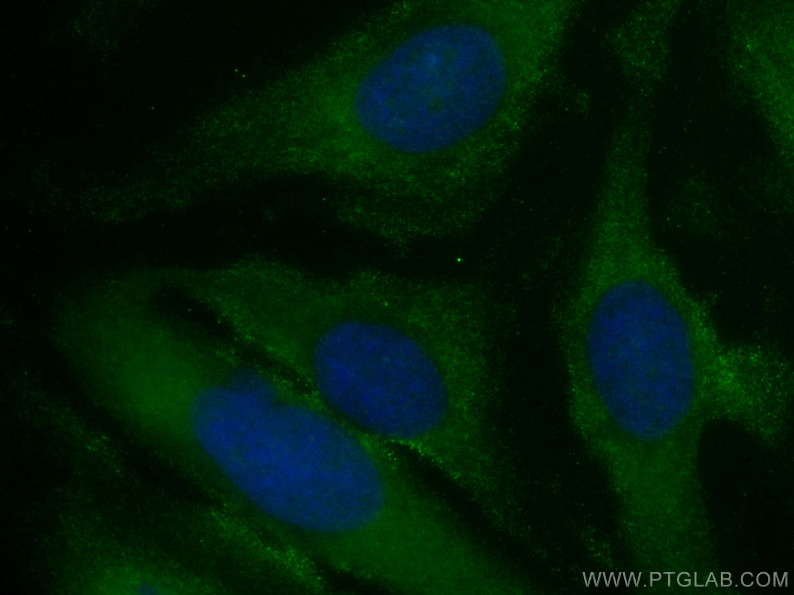 Apolipoprotein AI