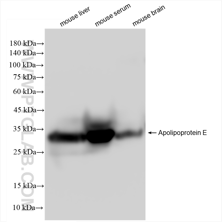 Western Blot (WB) analysis of various lysates using Apolipoprotein E Recombinant antibody (83728-4-RR)