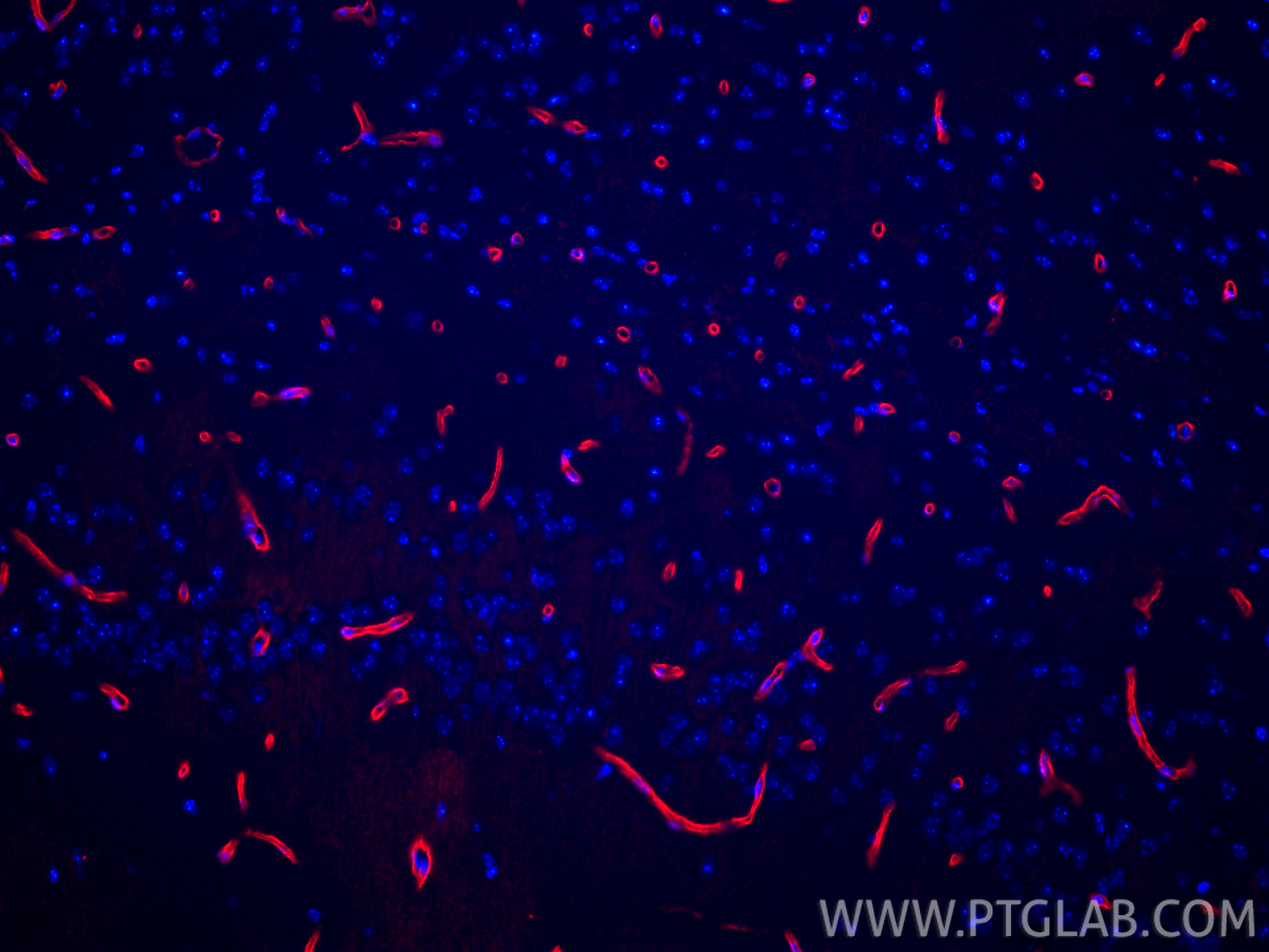 Immunofluorescence (IF) / fluorescent staining of mouse brain tissue using CoraLite®594-conjugated Aquaporin 4 Recombinant an (CL594-82296-6)