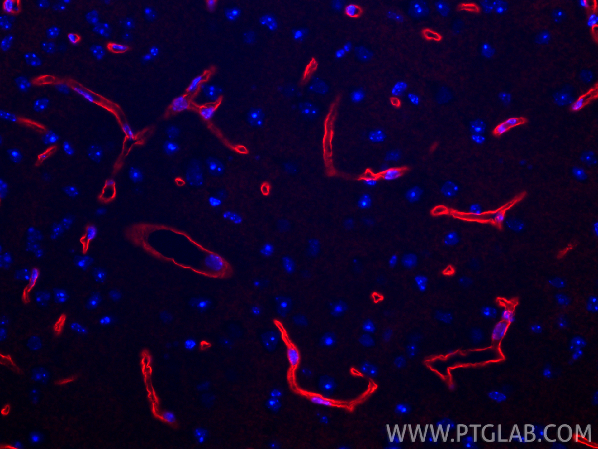 Immunofluorescence (IF) / fluorescent staining of mouse brain tissue using CoraLite®594-conjugated Aquaporin 4 Recombinant an (CL594-82296-6)