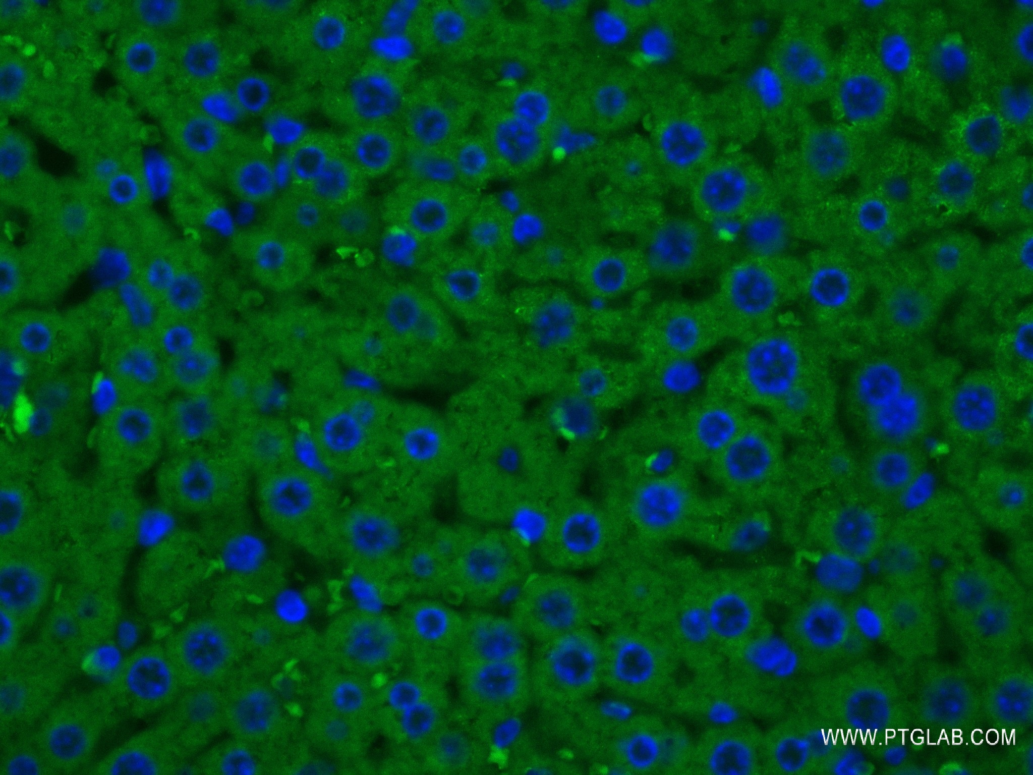 Immunofluorescence (IF) / fluorescent staining of mouse liver tissue using Arginase-1 Recombinant antibody (82975-1-RR)
