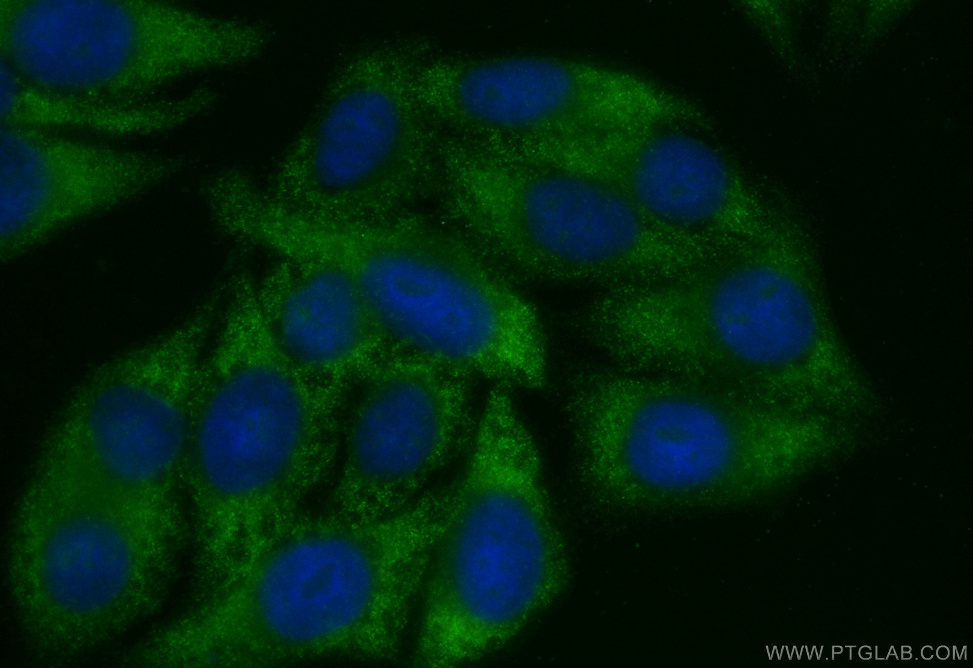 Immunofluorescence (IF) / fluorescent staining of HepG2 cells using Arginase-1 Recombinant antibody (82975-1-RR)