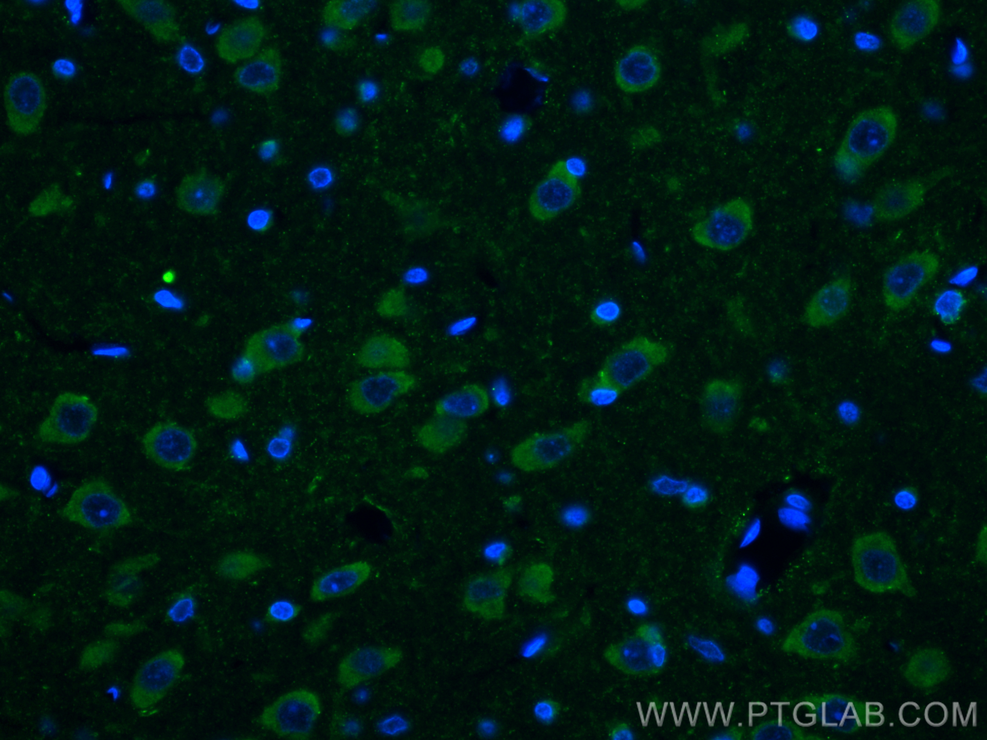 Immunofluorescence (IF) / fluorescent staining of rat brain tissue using Ataxin 2 Monoclonal antibody (68316-1-Ig)