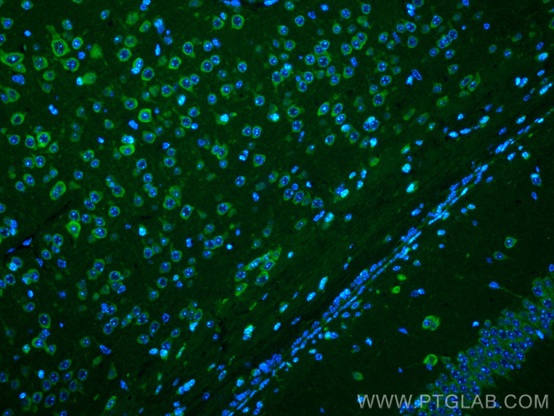 Immunofluorescence (IF) / fluorescent staining of mouse brain tissue using CoraLite® Plus 488-conjugated Ataxin 2 Polyclonal  (CL488-21776)