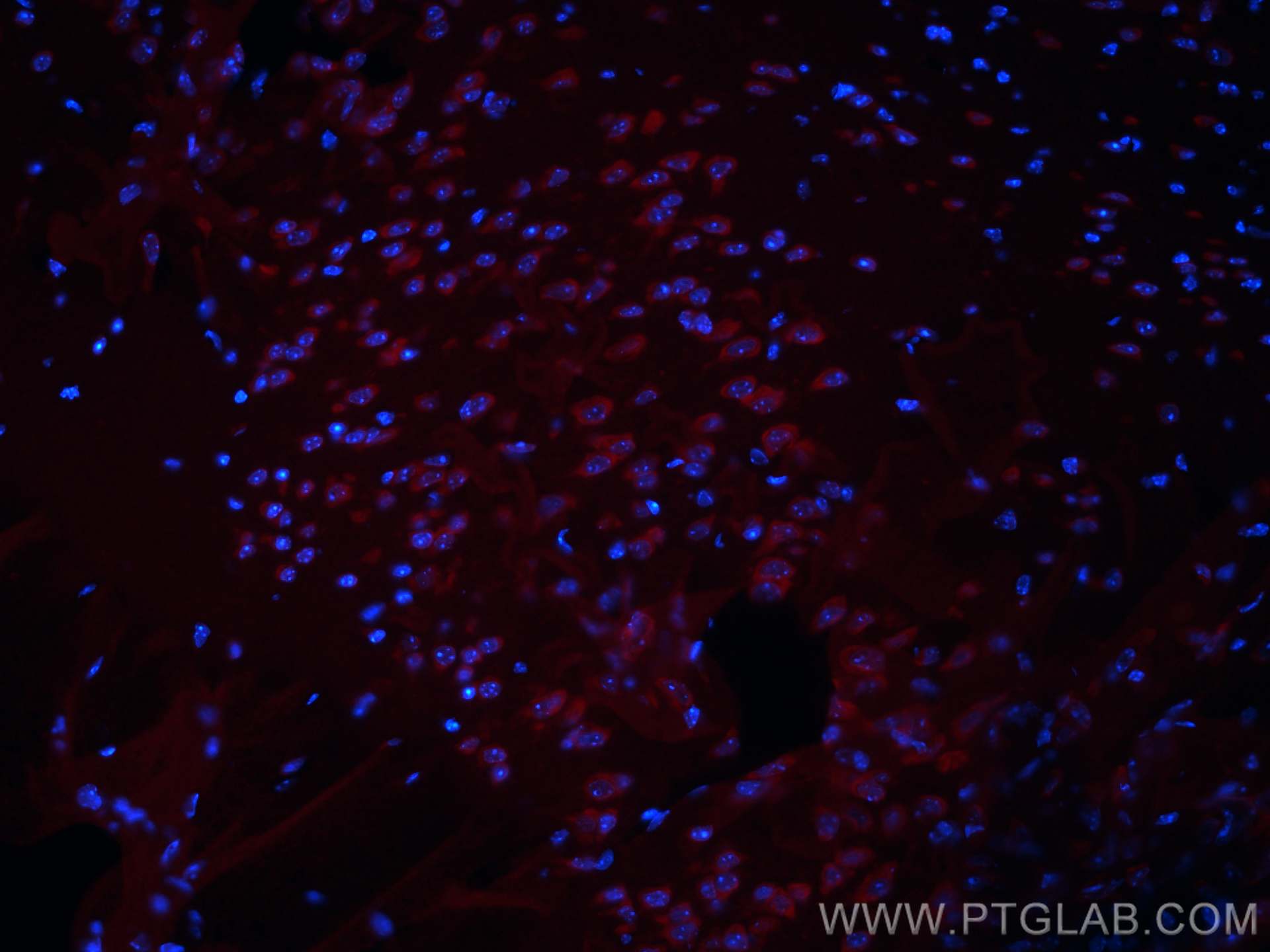 Immunofluorescence (IF) / fluorescent staining of mouse brain tissue using CoraLite®594-conjugated Ataxin 2 Polyclonal antibo (CL594-21776)