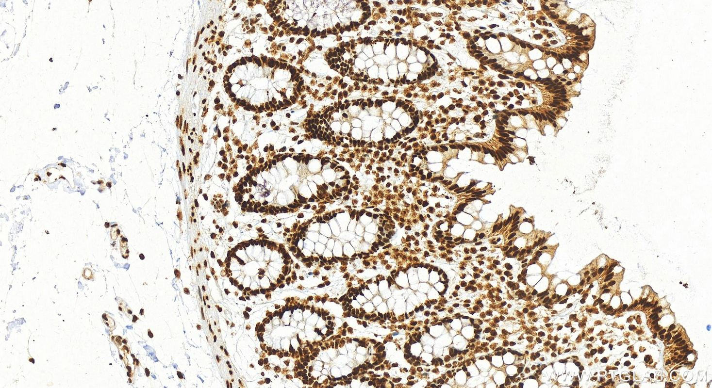 Immunohistochemistry (IHC) staining of human normal colon using B23/NPM1 Recombinant antibody (82030-1-RR)