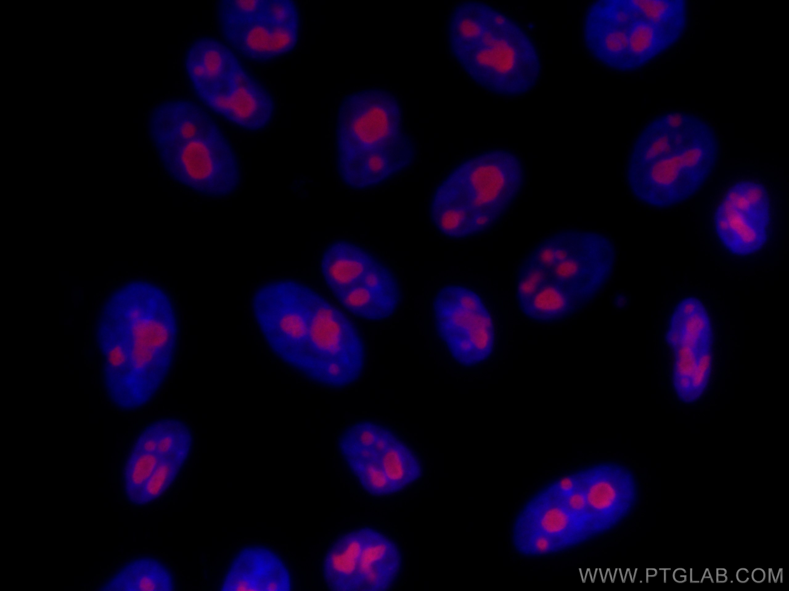 Immunofluorescence (IF) / fluorescent staining of HepG2 cells using CoraLite®568-conjugated B23/NPM1 Monoclonal antibo (CL568-60096)