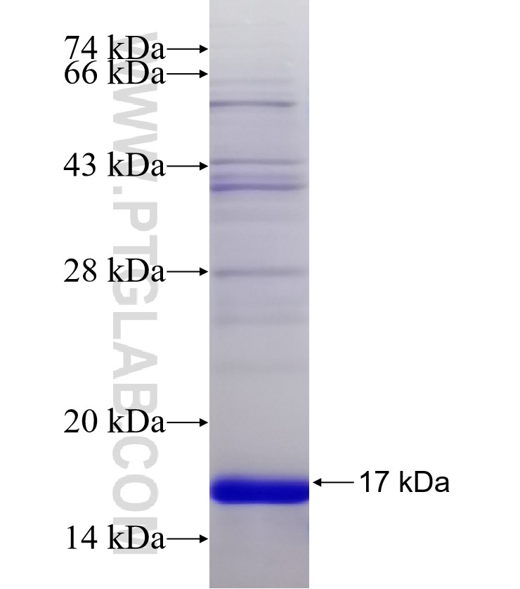 B3GALNT2 fusion protein Ag31400 SDS-PAGE