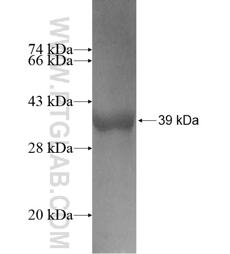 B3GALNT2 fusion protein Ag10860 SDS-PAGE