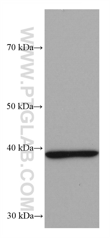 Western Blot (WB) analysis of mouse brain tissue using B3GAT1 Monoclonal antibody (66711-1-Ig)