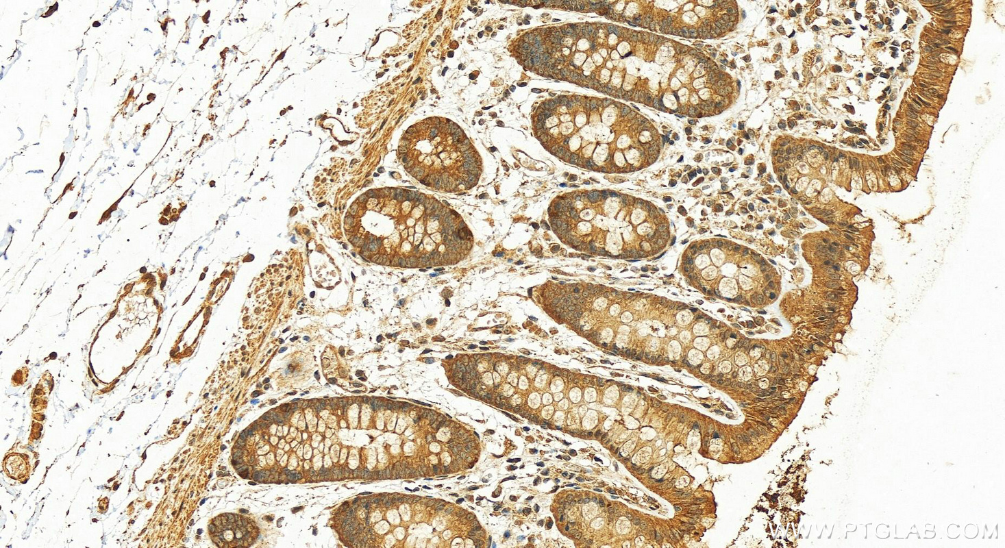 Immunohistochemistry (IHC) staining of human colon tissue using B4GALNT2 Polyclonal antibody (24024-1-AP)