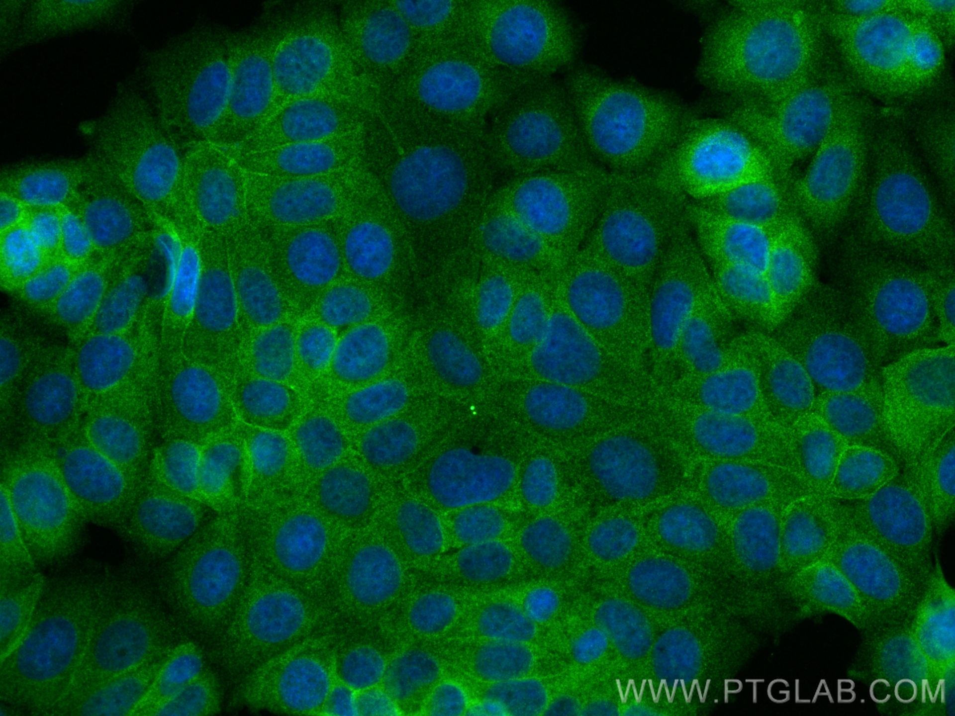 Immunofluorescence (IF) / fluorescent staining of MCF-7 cells using B4GALT3 Polyclonal antibody (11041-1-AP)