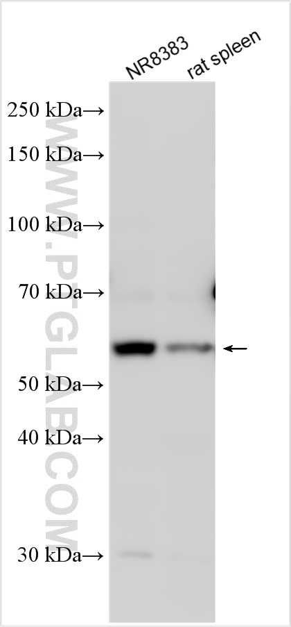 Western Blot (WB) analysis of various lysates using CD86 Polyclonal antibody (30691-1-AP)