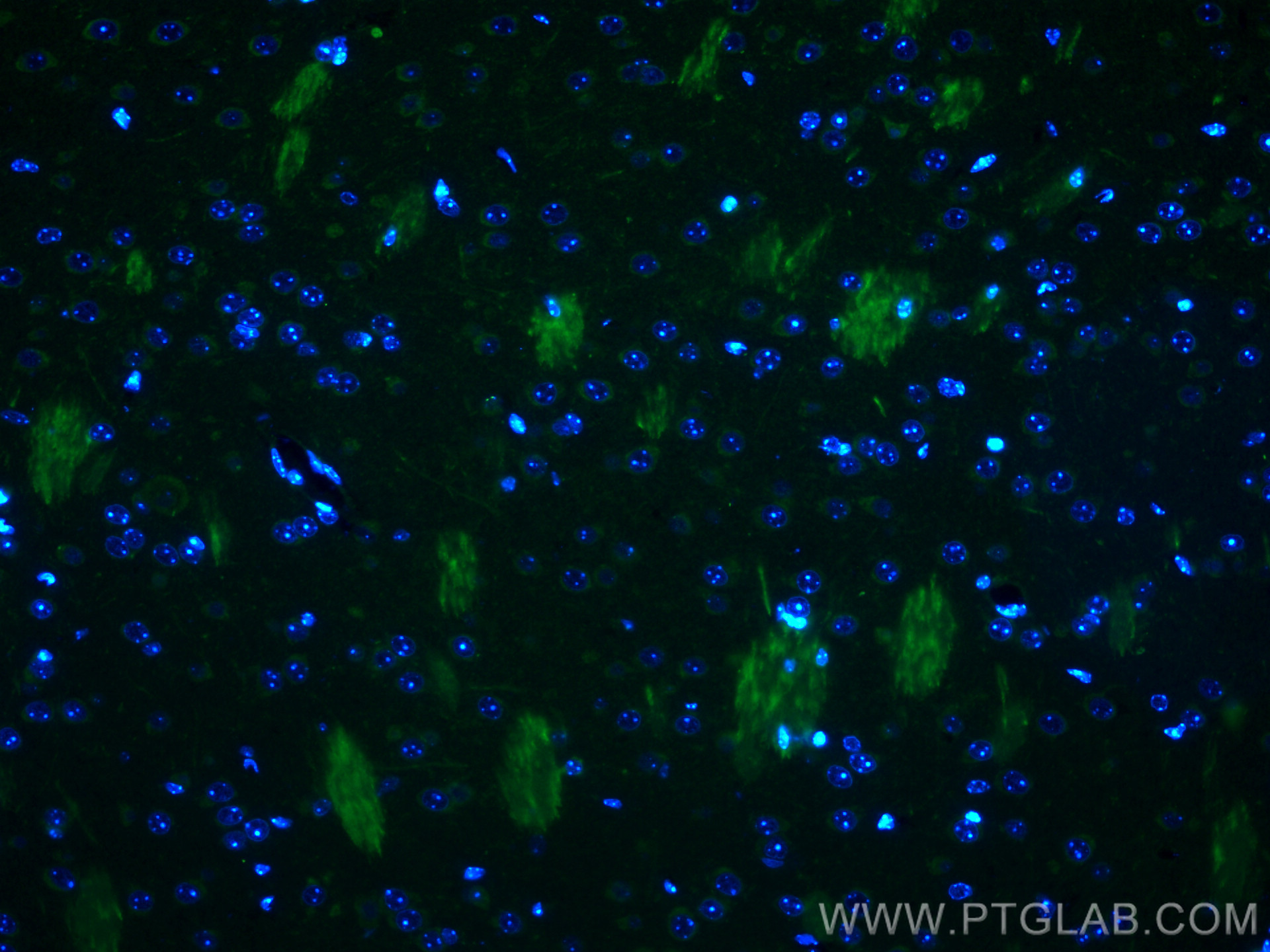 Immunofluorescence (IF) / fluorescent staining of mouse brain tissue using BACE1 Polyclonal antibody (12807-1-AP)