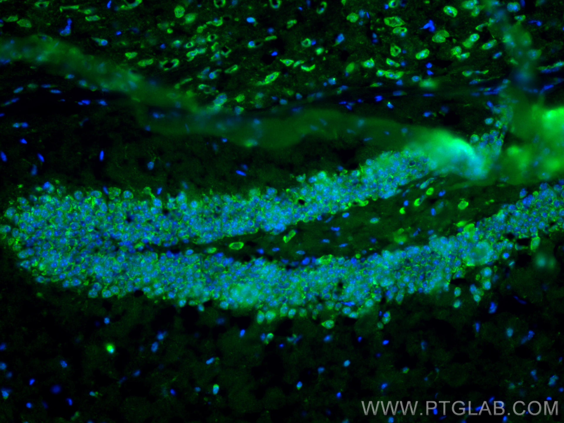 Immunofluorescence (IF) / fluorescent staining of mouse brain tissue using BACE1 Polyclonal antibody (12807-1-AP)