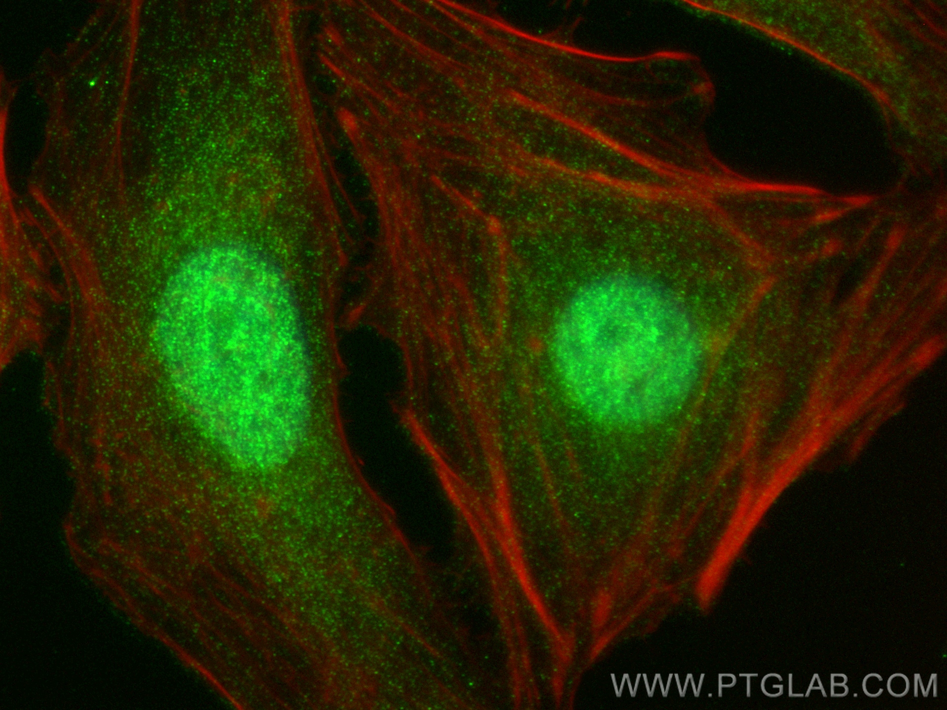 Immunofluorescence (IF) / fluorescent staining of HeLa cells using BACH1 Recombinant antibody (82842-7-RR)