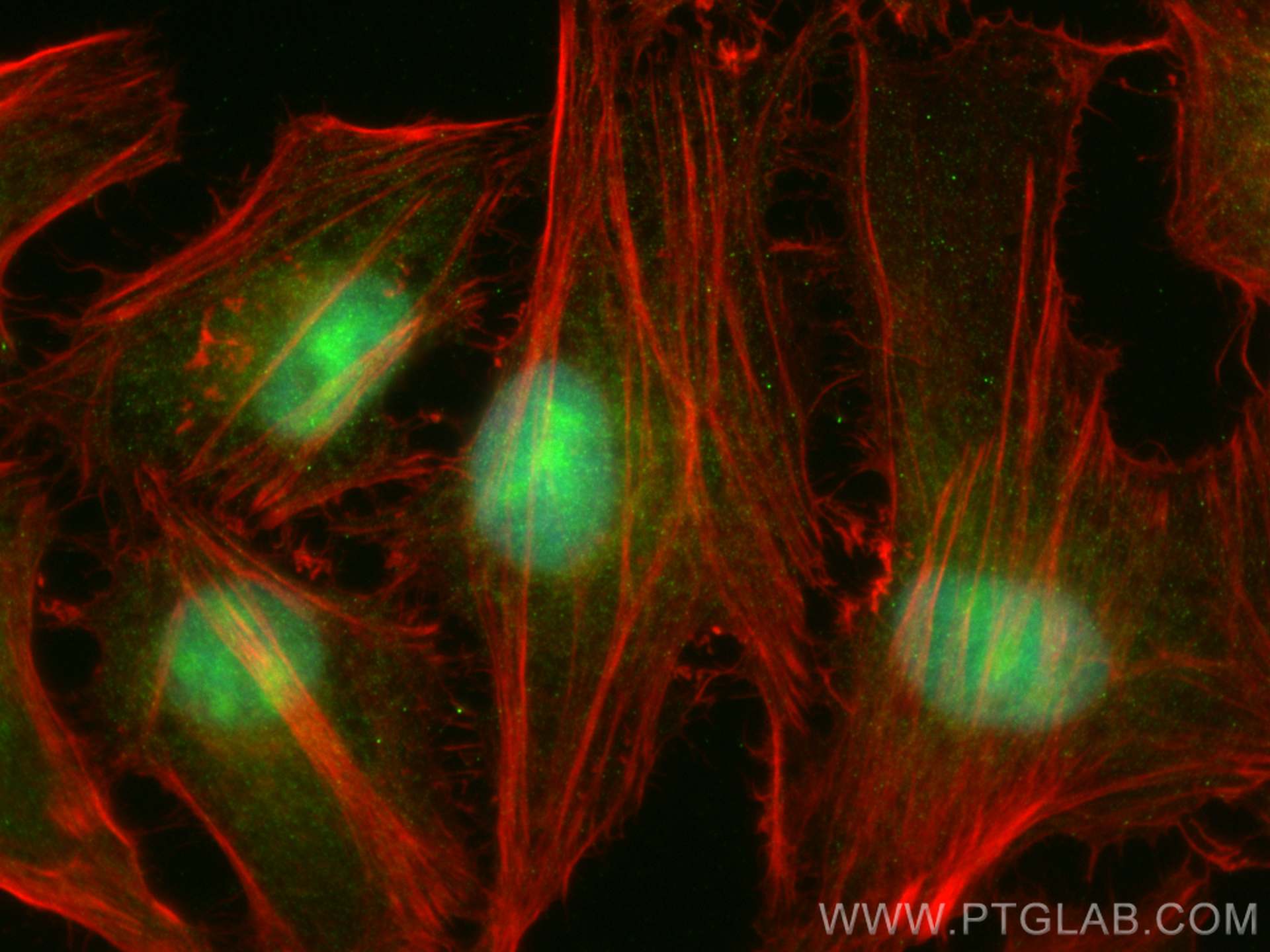 Immunofluorescence (IF) / fluorescent staining of HeLa cells using BAG1 Polyclonal antibody (19064-1-AP)