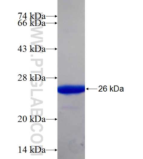 BAG6 fusion protein Ag25918 SDS-PAGE