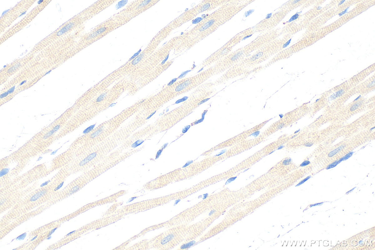Immunohistochemistry (IHC) staining of rat heart tissue using BAK Polyclonal antibody (29552-1-AP)